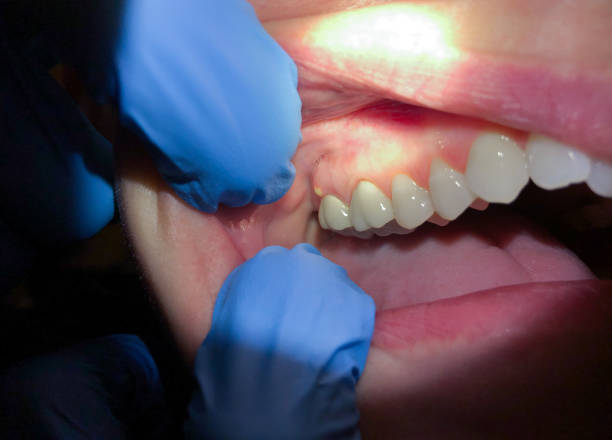 Best Emergency Treatment for Jaw Pain or Injury in Dumas, TX